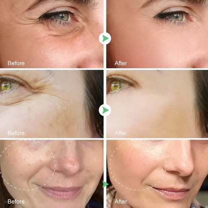 Retinol Remove Wrinkle Face Serum Lift Firming Anti Aging Fade Fine Lines Whitening Brightening Moisturizer Skin Care Cosmetics