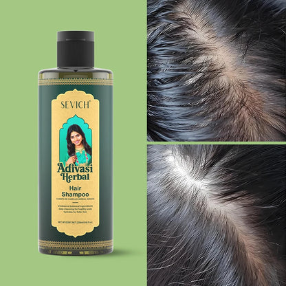 Hair Growth Oil Set Rosemary Hair Growth Oil Natural Herbal Hair Care Shampoo India Ayurvedic Anti Hair Loss Hair Regrowth Serum