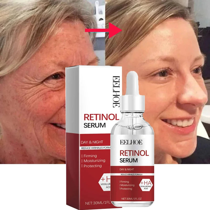 Retinol Anti Wrinkle Anti-Aging Face Cream Collagen Lotion,Neck & Eye Skin Lifting Tightening Moisturizing Serum Korean Skinare