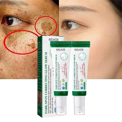 Dark Spot Corrector serum Fades Sunspots Brightens Dull Skin Nourishes skin Reduces Melanin Minimizes freckle for men and women