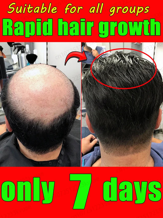 Double hair growth essential oil, the result of plant essence research, say goodbye to baldness and hair loss, without harming t