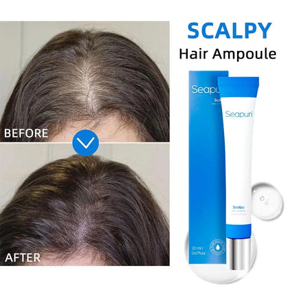 Seapuri Scalphy Hair Care Essence Scalp Clean Cooling & Refreshing Hair Essence Hair Fast Growth Strengthening Hair Care Essence