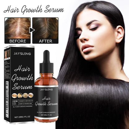 Hair Growth Oil Fast Hair Growth Effective Treatment for Baldness Hereditary Hair Loss Postpartum Hair Loss Seborrheic Hair Loss