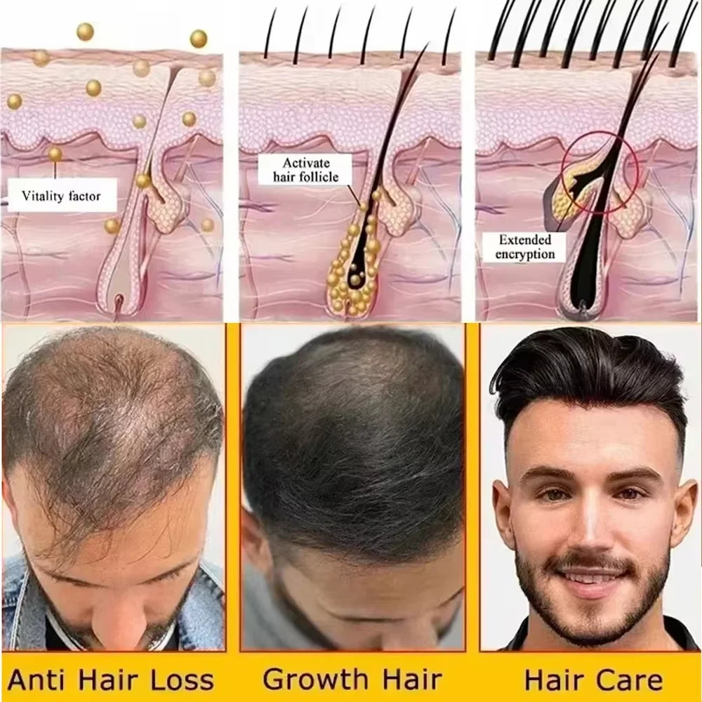 Fast Hair Growth Set Batana Oil Traction Alopecia Hair Mask Anti Break Loss Hair Growth Oil Baldness Treatment Hair Health Care