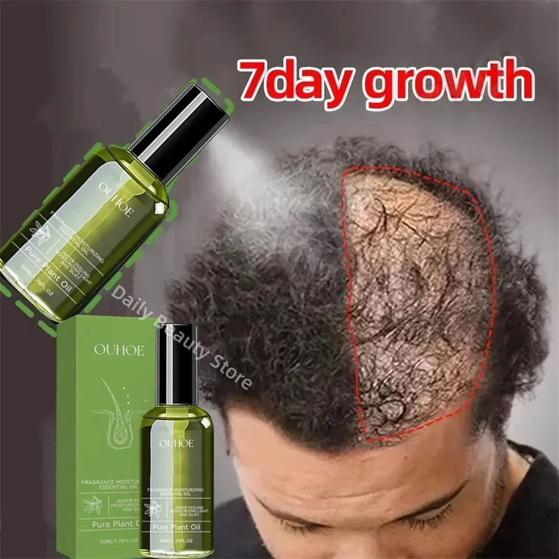 Fast Hair Growth Serum Spray Anti Hair Loss Prevent Baldness Scalp Treatment Repair Roots Beauty Health Hair Care For Men Women