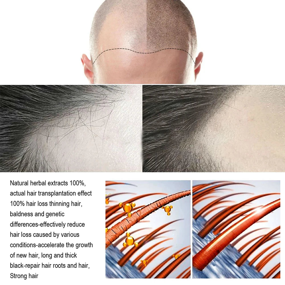 Fast Ginger Hair Growth Spray Roots Grow Anti Hair Loss Serum Liquid Scalp Damaged Treatment Repair Care Products Beauty Health