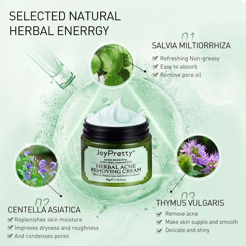 JoyPretty Herbal Day Cream For Acne Skin Care Face Moisturizer Oil Control Pimple Acne Scar Removal Cream Treatment For Women