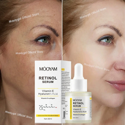 Retinol Facial Essence 2.5% with Hyaluronic Acid VE Anti-Aging Serum for Smooth Skin And Acne Treatment face Reduces Wrinkles