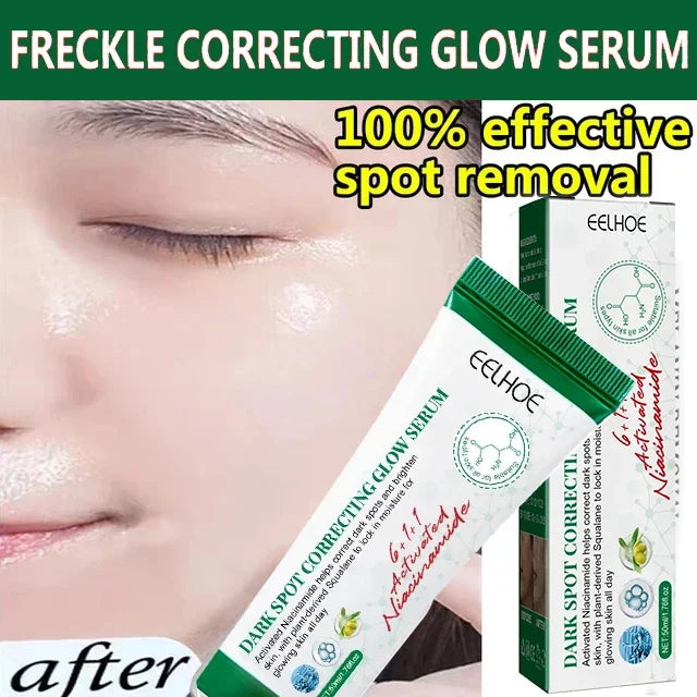 Niacinamide Melasma Brightening Cream Reduce Melanin Brighten Cream Lighten Dark Skin Chloasma Serum Fade Fine Face Lines