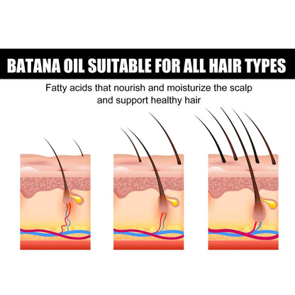 30ml African Batana Oil Hair Growth Spray Fast Repair Baldness Hereditary Postpartum Seborrheic Hair Loss Treatment Serum