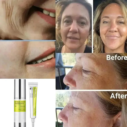 Korean Vita A Retinol Shot Tighten Booster Serum & Eye cream Lifting Anti-Aging Pore Shrink Dark Circles Repair Skin Care Set