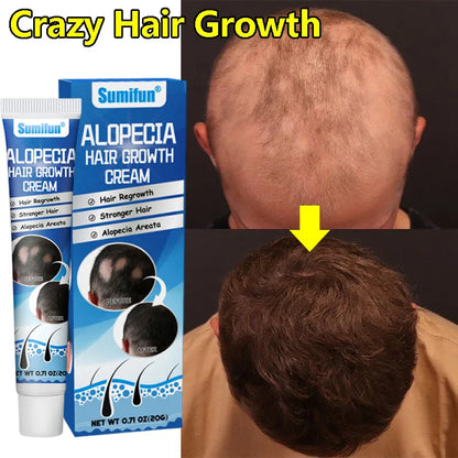 7 days Fast Hair Growth Cream Anti Hair loss Prevent Baldness Scalp Treatment Repair Roots Beauty Health Hair Care For Men Women