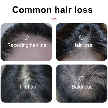 Anti-Hair Loss Roller Massage Hair Growth Serum Improve Hair Lose Care Biotin Herbal Serum Growth Nourishing Soothing Scalp Seru