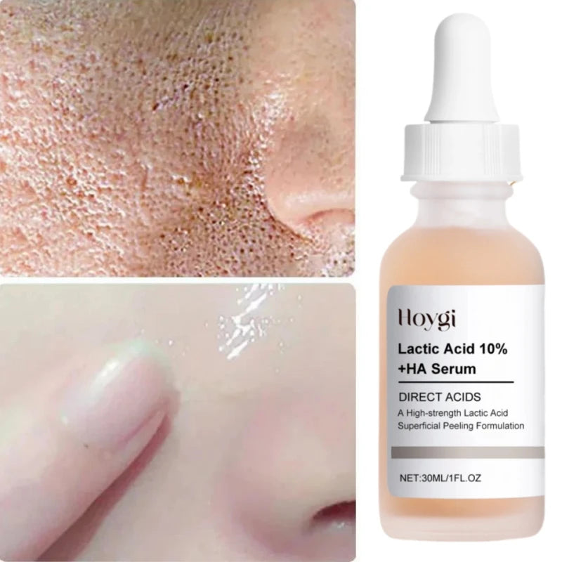 Lactic Acid Large Pores Removal Serum Facial Fast Eliminate Pore Shrinking Essence Firm Skin Moisturizing Hydration Care Product