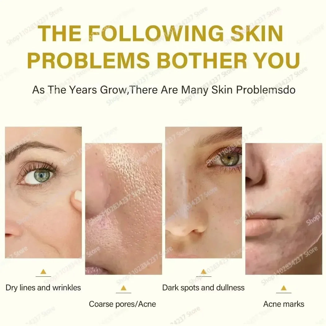 With Malic Acid And Citric Acid For Face  Facial Peel 40% Peeling Serum Peeling Serum Chemical Peel