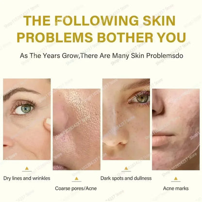 With Malic Acid And Citric Acid For Face  Facial Peel 40% Peeling Serum Peeling Serum Chemical Peel