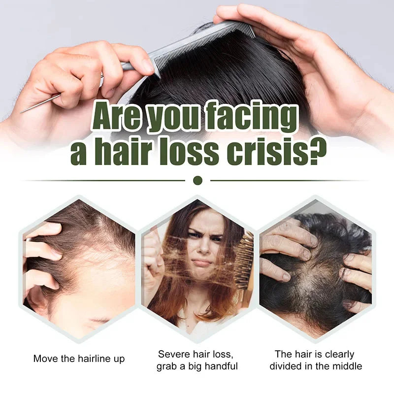 Fast Hair Growth Oil Africa Crazy Traction Alopecia Serum Anti Hair Break Thicken Hair Loss Treatment Spray For Man Women 60ML