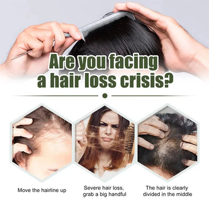 Fast Hair Growth Oil Africa Crazy Traction Alopecia Serum Anti Hair Break Thicken Hair Loss Treatment Spray For Man Women 60ML