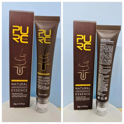 PURC Ginger Hair Growth Serum Hair Loss Treatment Fast Hair Growth Products for Men Women Hair Care