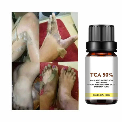 With Malic Acid And Citric Acid For Face  Facial Peel 40% Peeling Serum Peeling Serum Chemical Peel