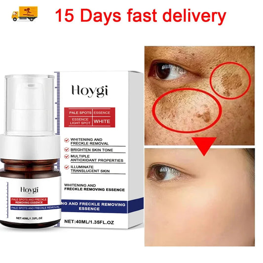 Powerful Dark Spots Remover Whiten Serum Cream Vitamin C Skin Brighten Serum Removal Melasma Dark Spots Repair Beauty Skin Care