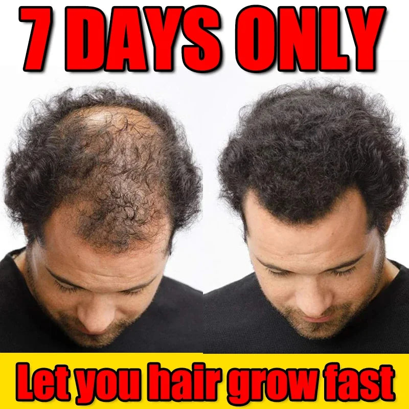 Hair Growth Oil Effective Baldness Repair Hereditary Postpartum Seborrheic Hair Loss for Women & Men Fast Hair Growth Oil