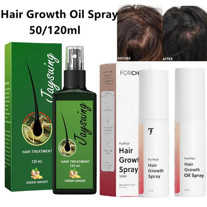 ForHair Advanced Hair Growth Serum for Scalp – Strengthens, Thickens & Accelerates Hair Growth- Non-Greasy Hair Growth Oil Spray