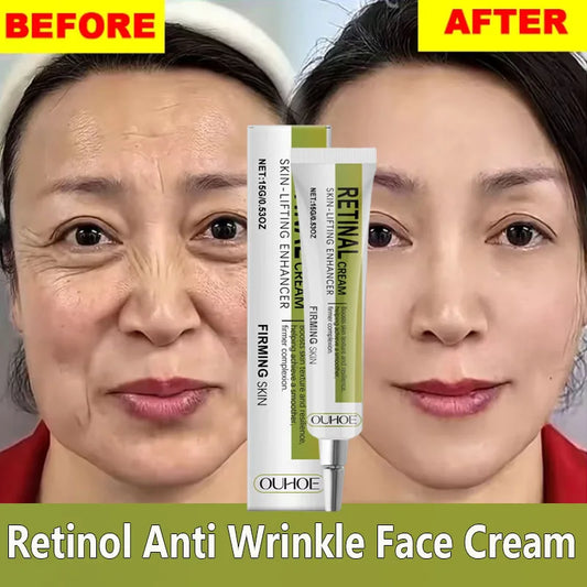 Retinol Cream Tightening Anti Wrinkle Improve Sagging Moisturizing Smoothing Lightening Firming Radiant Fine Lines Removal Cream