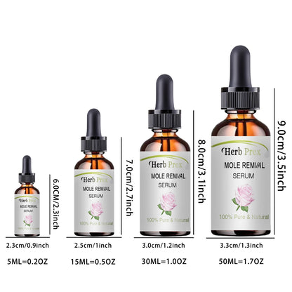 5ML/15ML/30ML/50ML/Spot removing cream, removing and spot whitening cream, moisturizing and caring for the skin