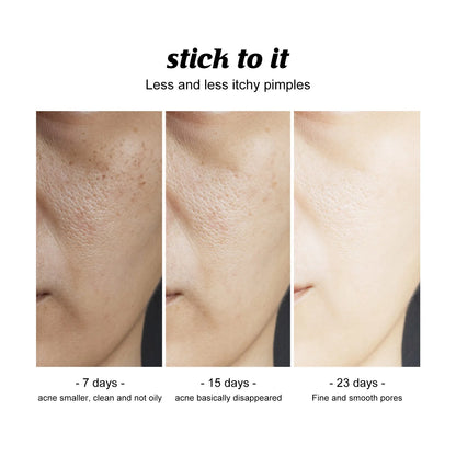 Facial Cleansing Bar for Gentle Exfoliating Soap with Avocado Macadamia Oil Smooth Care Moisturizing Face and Body Soap 120g