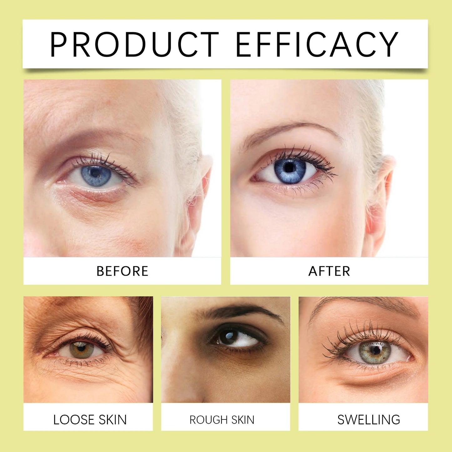 Hoygi 15g Retinol Eye Cream Gentle Renewing Formula for Delicate Eye Area Hydrates Improves Skin Texture Night Use Recommended