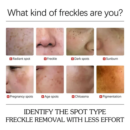 Dark Spot Removal Serum Effectively lightens and diminishes dark spots smoothen & refines the skin's texture Moisturizing Repair