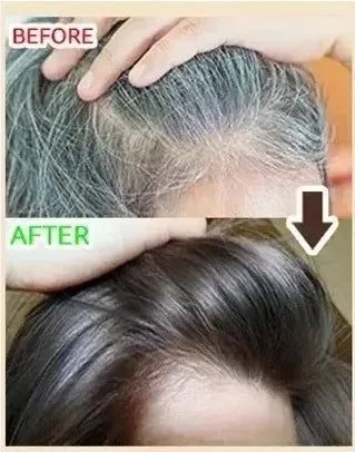 Herbs for White Hair Shampoo Conditioning Oil Control Cleansing with Platycladus Multiflorum And Angelica Root 14 Kinds of Hair