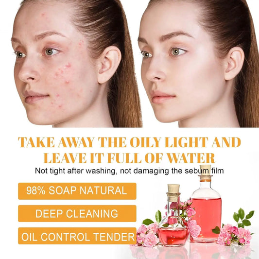 Turmeric Kojic Acid Blackhead Remover Cleanser Deeply Cleansing Skin Cleansing Oil Control Fade Acne Marks Brighten Foam Cleanse