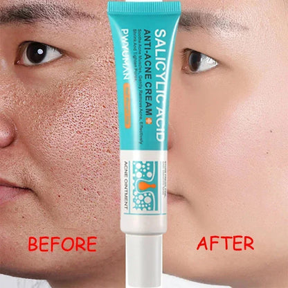 Salicylic Acid Pore Shrinking Cream Quick Eliminate Large Pores Remove Blackehead Tighten Repair Face Smooth Skin Care Products