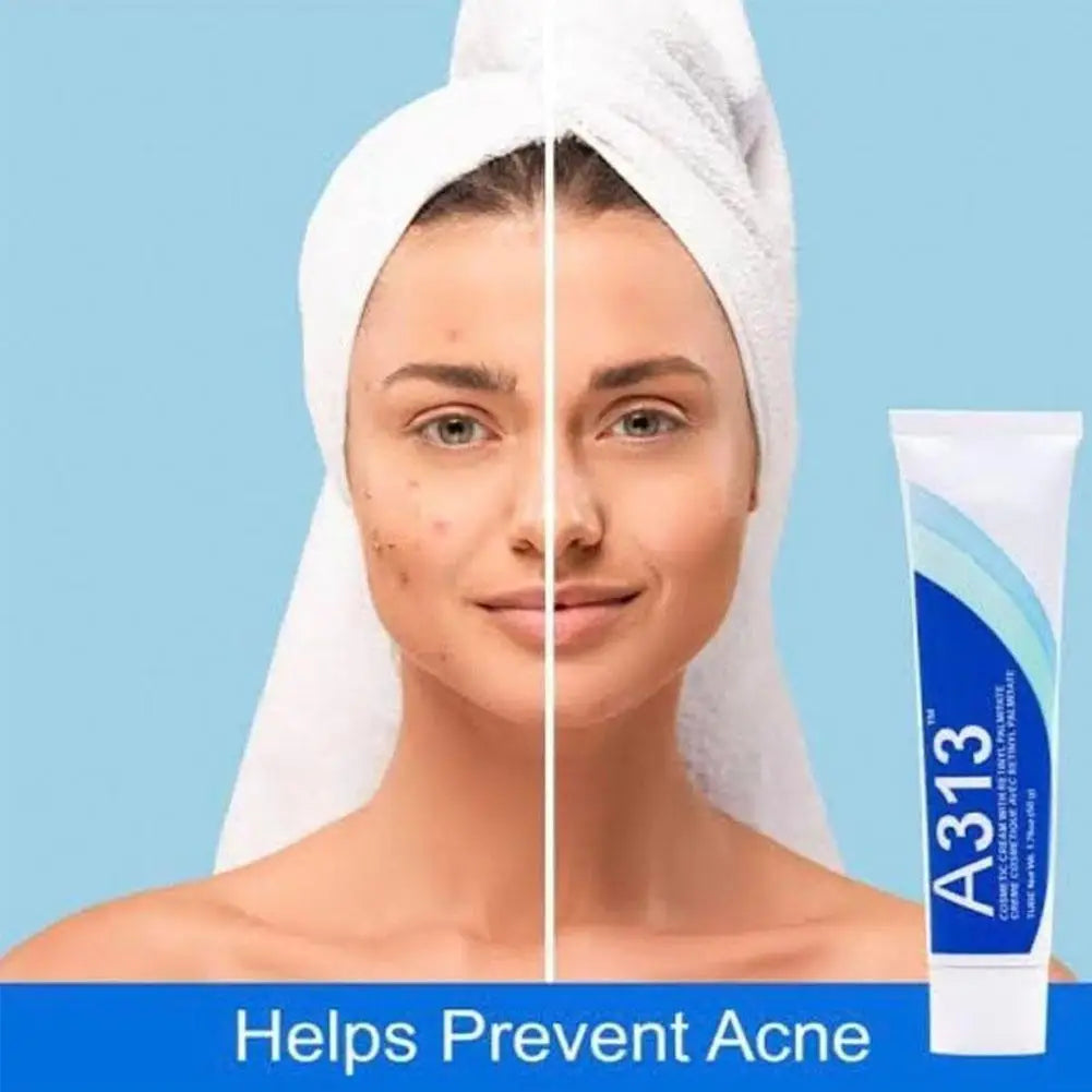 A313 Retinol Pommade Vitamin A Reduce Fine Lines And Wrinkles Night Mousturizer Deeply Nourishing Firming And Smoothing Skin