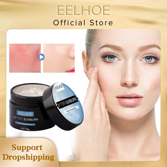 EELHOE After Sun Repair Cream Aloe Vera Sunburn Repair Gel Face Body Refreshing Moisturizing Protection Skin Care Free Shipping