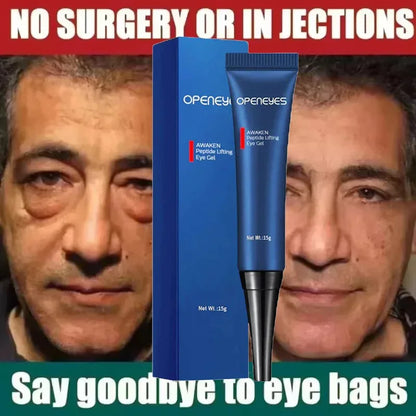 Men Retinol Eye Bags Remover Cream