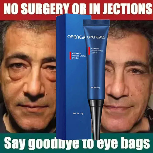 Men Retinol Eye Bags Remover Cream