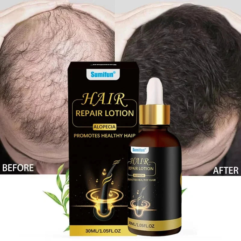 Fast Hair Growth Set Batana Oil Traction Alopecia Hair Mask Anti Break Loss Hair Growth Oil Baldness Treatment Hair Health Care