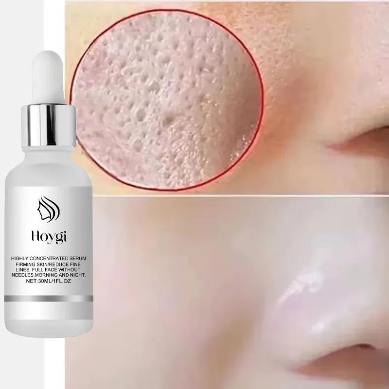 Remove Large Pores Serum Lactic Acid Facial Pore Shrinking Repairing Products Pore Minimizing Firming Smooth Korean Skin Care.