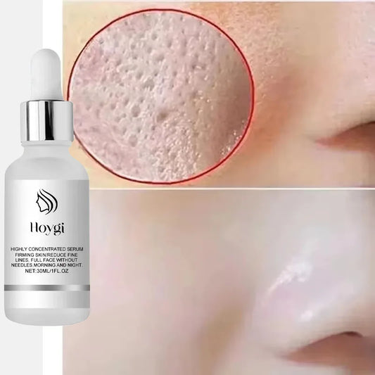 Remove Large Pores Serum Lactic Acid Facial Pore Shrinking Repairing Products Pore Minimizing Firming Smooth Korean Skin Care.