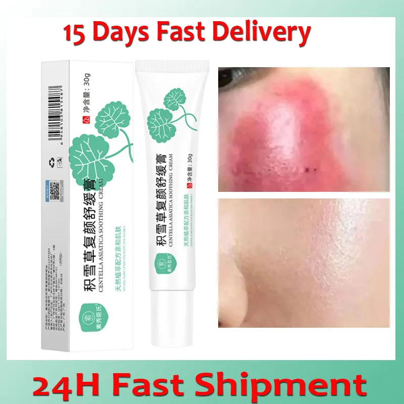 Facial Redness Repair Cream Improve Sensitive Muscles Acne Rosacea Dry&Itchy Skin Moisturizer Lotion Korean skincare products