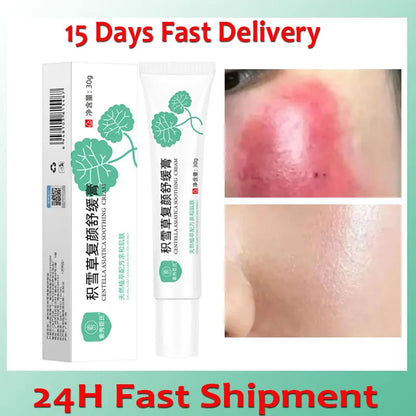Facial Redness Repair Cream Improve Sensitive Muscles Acne Rosacea Dry&Itchy Skin Moisturizer Lotion Korean skincare products