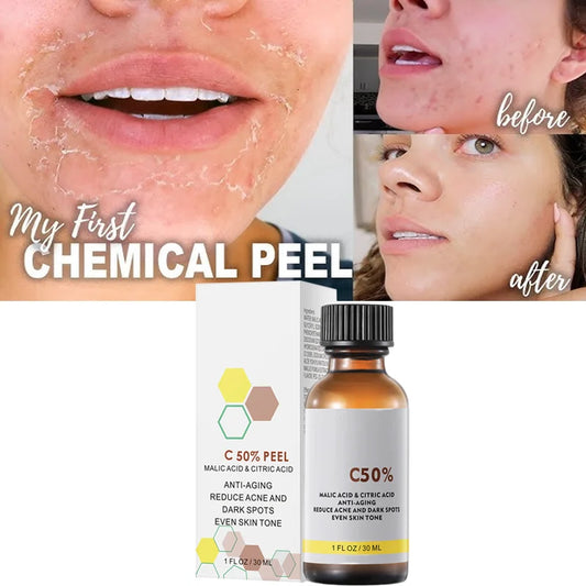With Malic Acid And Citric Acid For Face Facial Peel 40% Peeling Serum Peeling Serum Chemical Peel Whitening Nourishing Essence