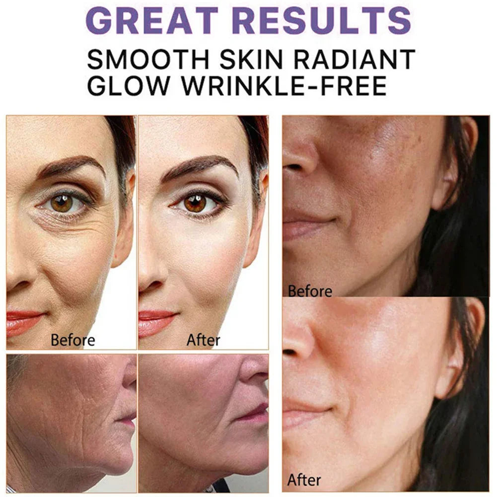 Retinol Remove Wrinkle Face Cream Anti-Aging Firming Lifting Fade Fine Lines Improve Puffiness Moisturizing Brighten Skin Care