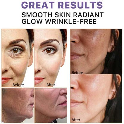 Retinol Remove Wrinkle Face Cream Anti-Aging Firming Lifting Fade Fine Lines Improve Puffiness Moisturizing Brighten Skin Care