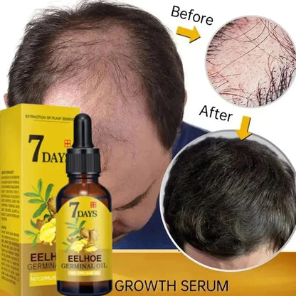 7 Day Fast Hair Growth Serum Ginger Growing Hair Treatment Anti Hair Loss Men Women Scalp Repair Damaged Root Care Essential Oil
