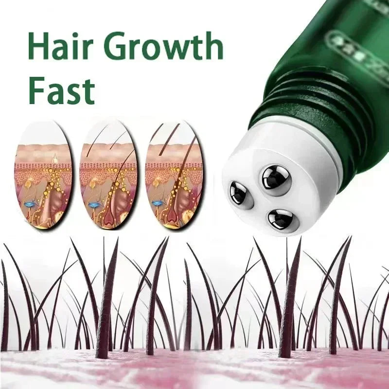 Scalp care  Hair Growth Oil Rapid Growth Hereditary & Postpartum Loss Seborrheic Relief Hair Repair Products with Ball Bearings