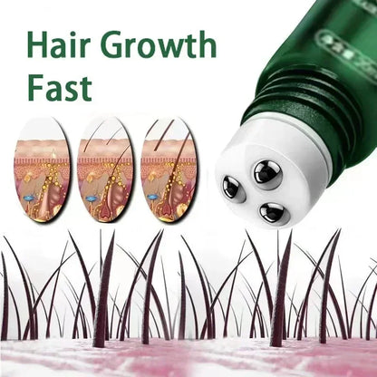 Scalp care  Hair Growth Oil Rapid Growth Hereditary & Postpartum Loss Seborrheic Relief Hair Repair Products with Ball Bearings